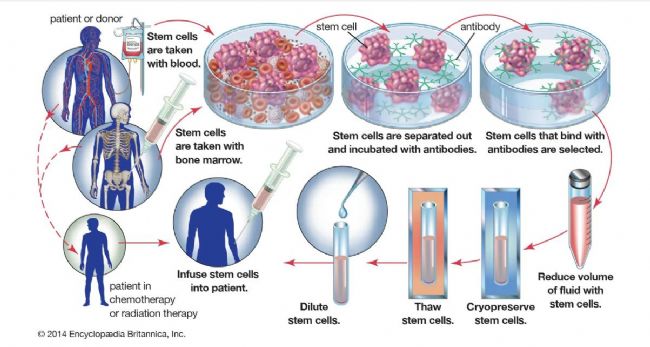 LABCONCO凍干機：冷凍保存技術(shù)在冷凍和儲存造血干細胞上的應用